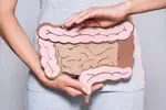 Your gut hormones can easily become disrupted due to drugs and illness. Also using hormone treatments and pain meds to help manage endometriosis will also throw your gut out of whack. 