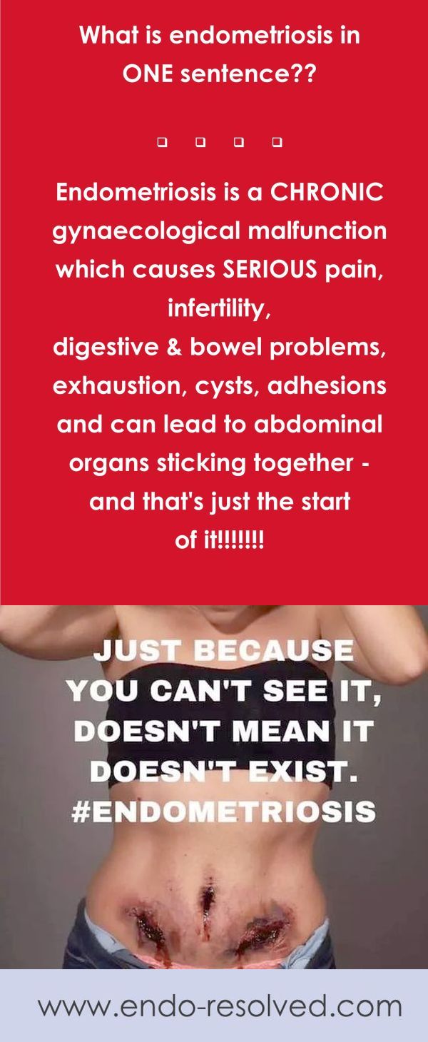 Endometriosis Explained