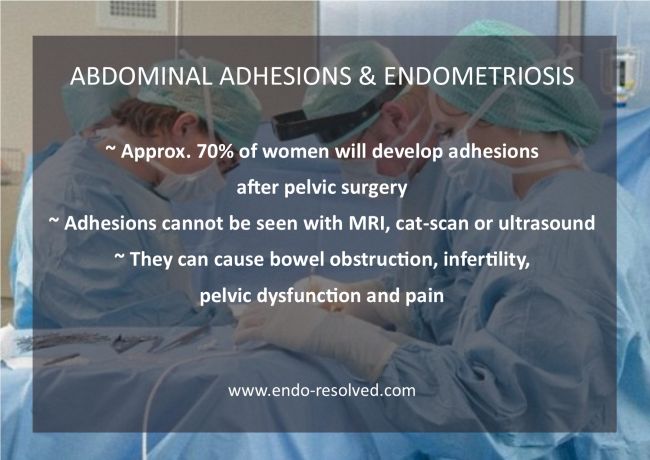 A description of adhesions and how they are caused by the disease or by post operative scarring