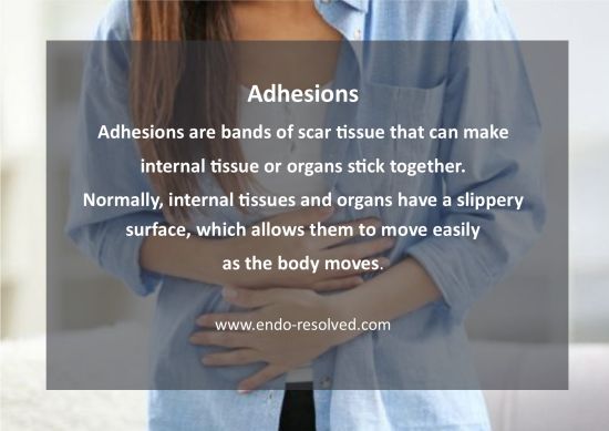 Endometriosis adhesions