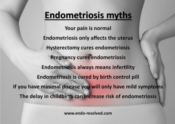 Endometriosis myths