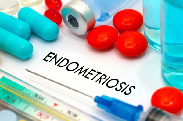 Endometriosis pain medication