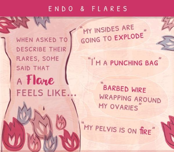 Endometriosis flare symptoms