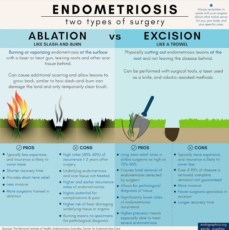 excision versus ablation