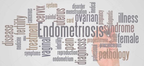 Cause of endometriois