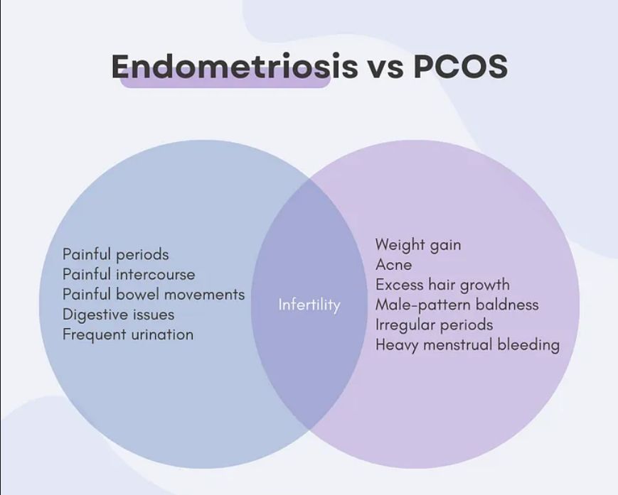 Endometriosis and PCOS endometriosis and PCOS