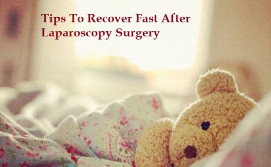 laparoscopy for endometriosis advice