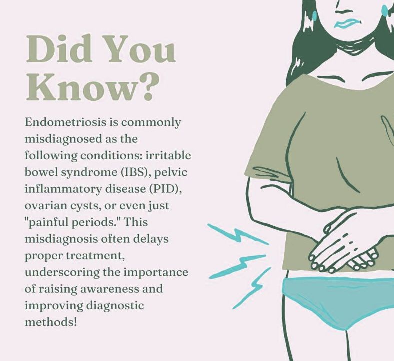 endo misdiagnosed